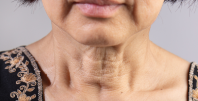Yoga Facial para la Flacidez